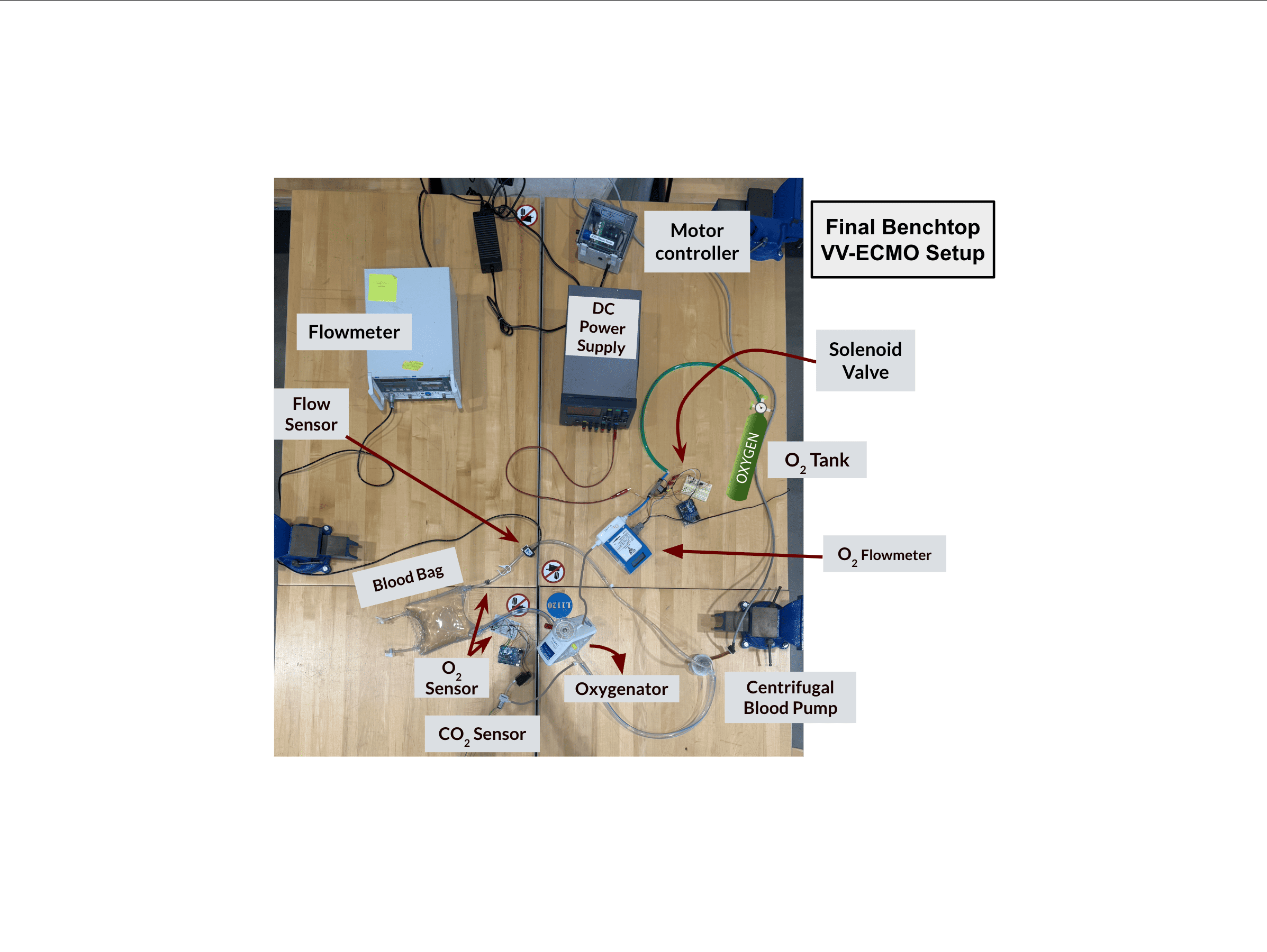 BIOE Team 16: Autonomous Control of Veno-venous Extracorporeal Membrane Oxygenation (ECMO) project image