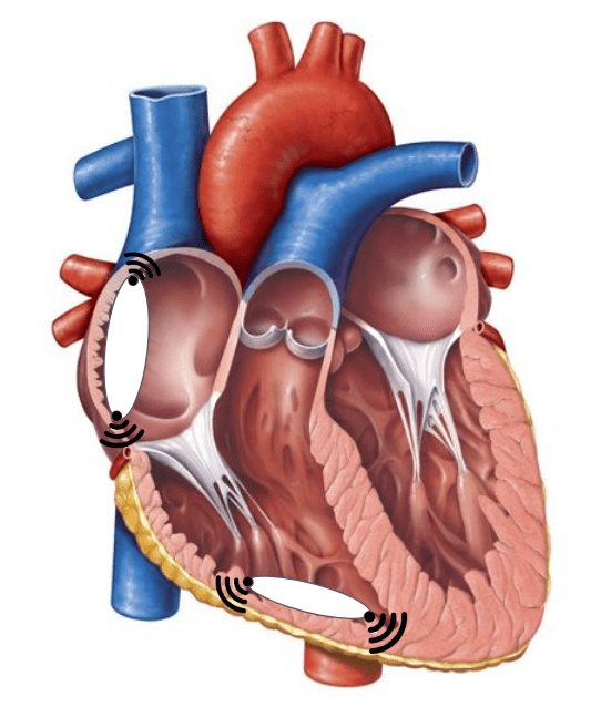 HeartNSYNC project image